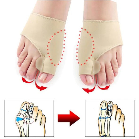 Joanete Pro®- Corretor de Joanetes
